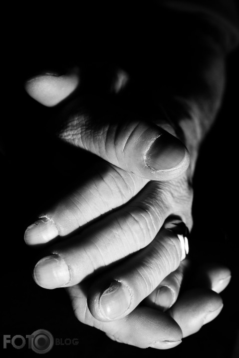 will you bite the hand that feeds you