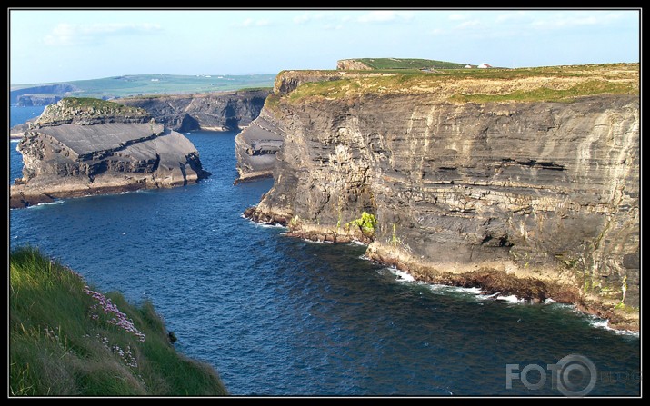 Loop head